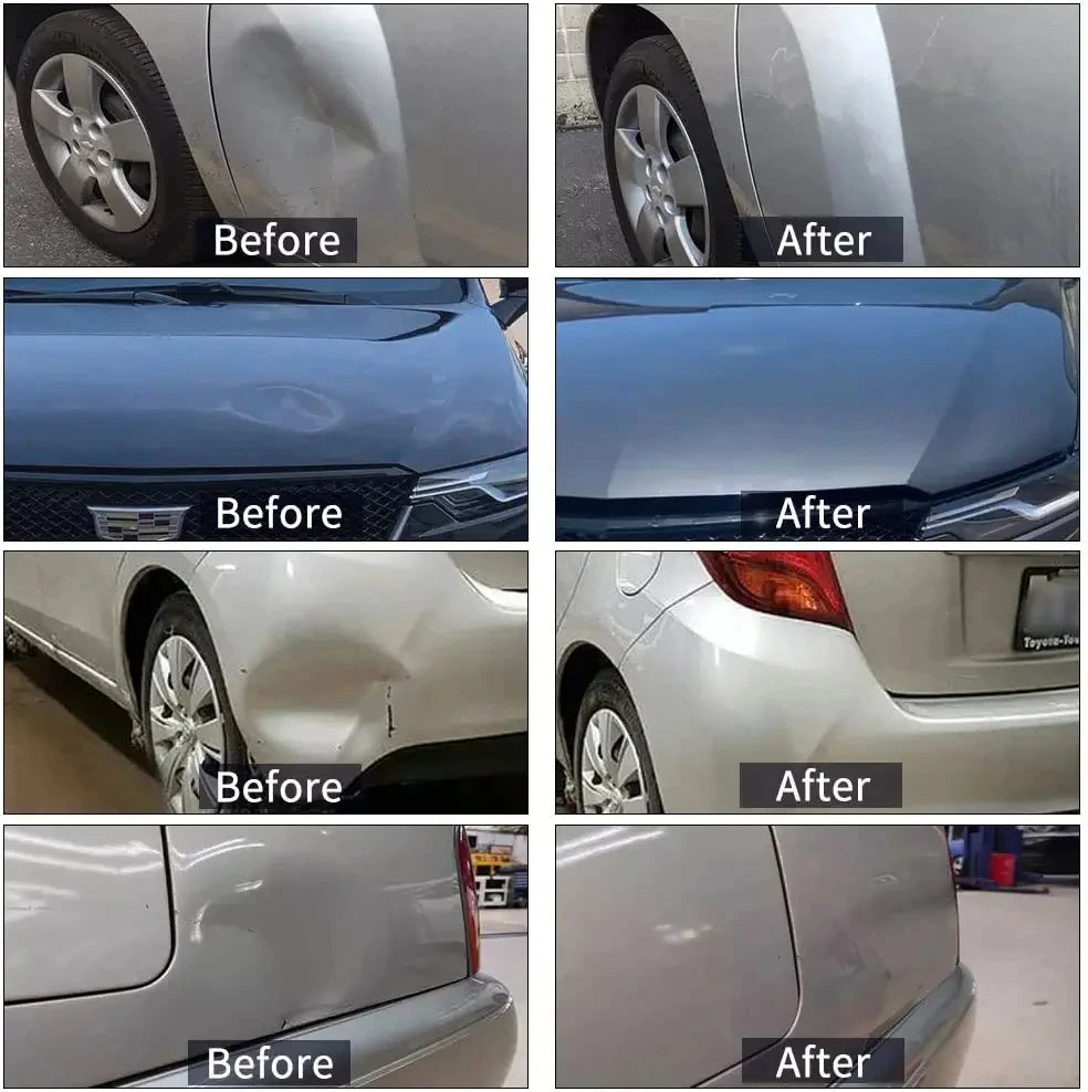 Super PDR Professional Dent Repair Tool Paint-free Dent Repair Tool Car Hail Dent Removal Kit Suction Cup Dent Puller Tool Set